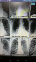Medical Records