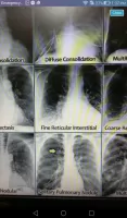 Medical Records
