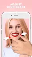 Braces Photo Editor