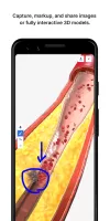 BioDigital Human