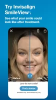 My Invisalign