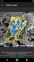 Bacteria: Types, Infections