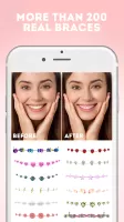 Braces Photo Editor