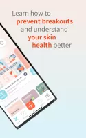 Akvile AI - Skin Health