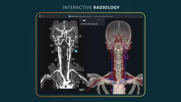 Complete Anatomy 2024